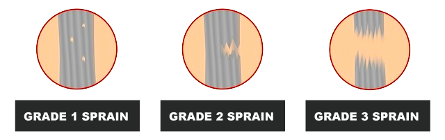 Hamstring Injury Grades